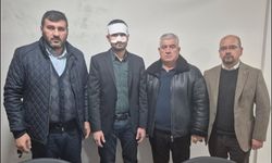 Eskişehir’de müdür yardımcısına sıcak çaylı saldırı!