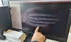 Eskişehir’de Her Ay 5-7 Çocuk Kanser Tanısı Alıyor