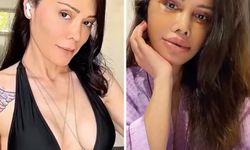 Didem Ceran Neden Yüz Nakli Oldu?