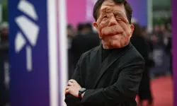 Adam Pearson Kimdir, Yüzüne Ne Oldu?