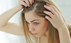 Saç Dökülmesine Dur De! Doğal Yöntemlerle Güçlü Saçlar