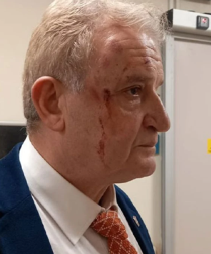 Eskişehir'de gazeteciye saldırıyla ilgili 2 şüpheli tutuklandı