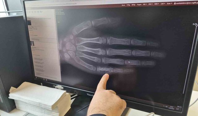 Eskişehir’de Her Ay 5-7 Çocuk Kanser Tanısı Alıyor