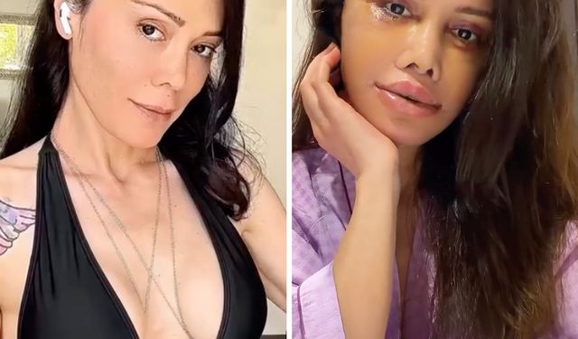 Didem Ceran Neden Yüz Nakli Oldu?