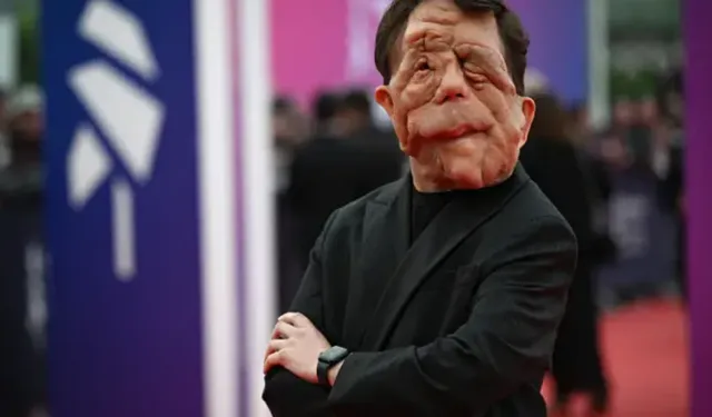 Adam Pearson Kimdir, Yüzüne Ne Oldu?