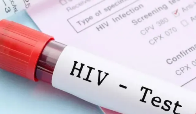 AIDS’e Karşı En Güçlü Silah: Bilgi, Farkındalık ve Erken Teşhis
