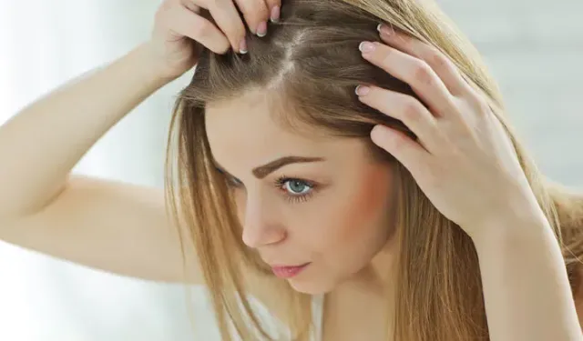 Saç Dökülmesine Dur De! Doğal Yöntemlerle Güçlü Saçlar