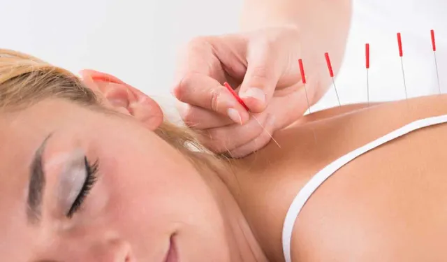 Akupunktur: İlaçsız Sağlık Çözümü!