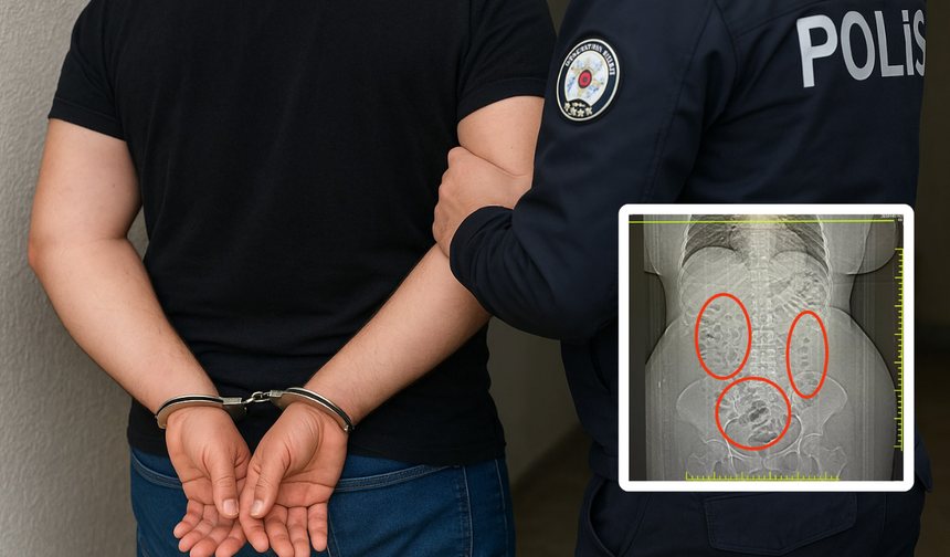 Eskişehir'de Midesindeki Yasaklı Maddelerle Yakayı Ele Verdi