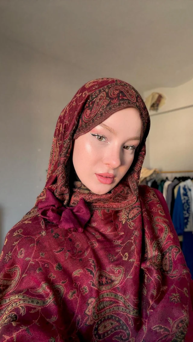 Fatma Soydasin Estetiksiz Hali 7C1845A354 8443 3 M