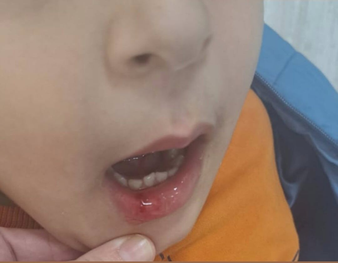 Özel Anaokulda Darp Iddası