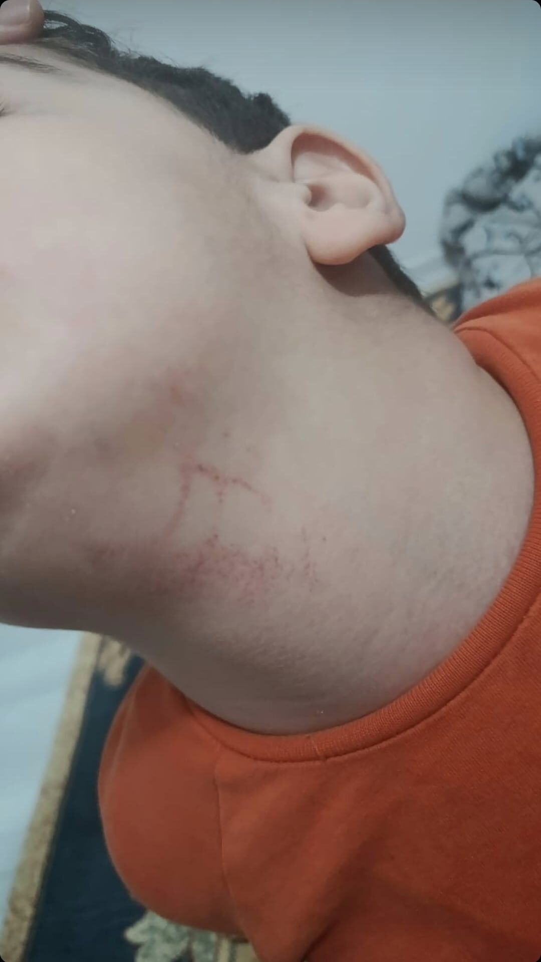 Özel Anaokulunda Darp Edildi Eğitim Hakkı Alındı