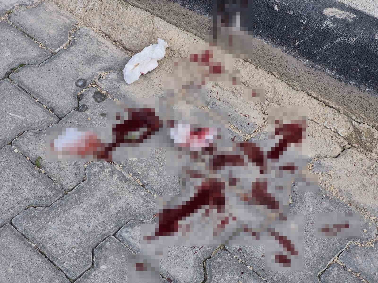 Esentepe'de 16 Yaşındaki Çocuk Hastanelik Oldu (1)