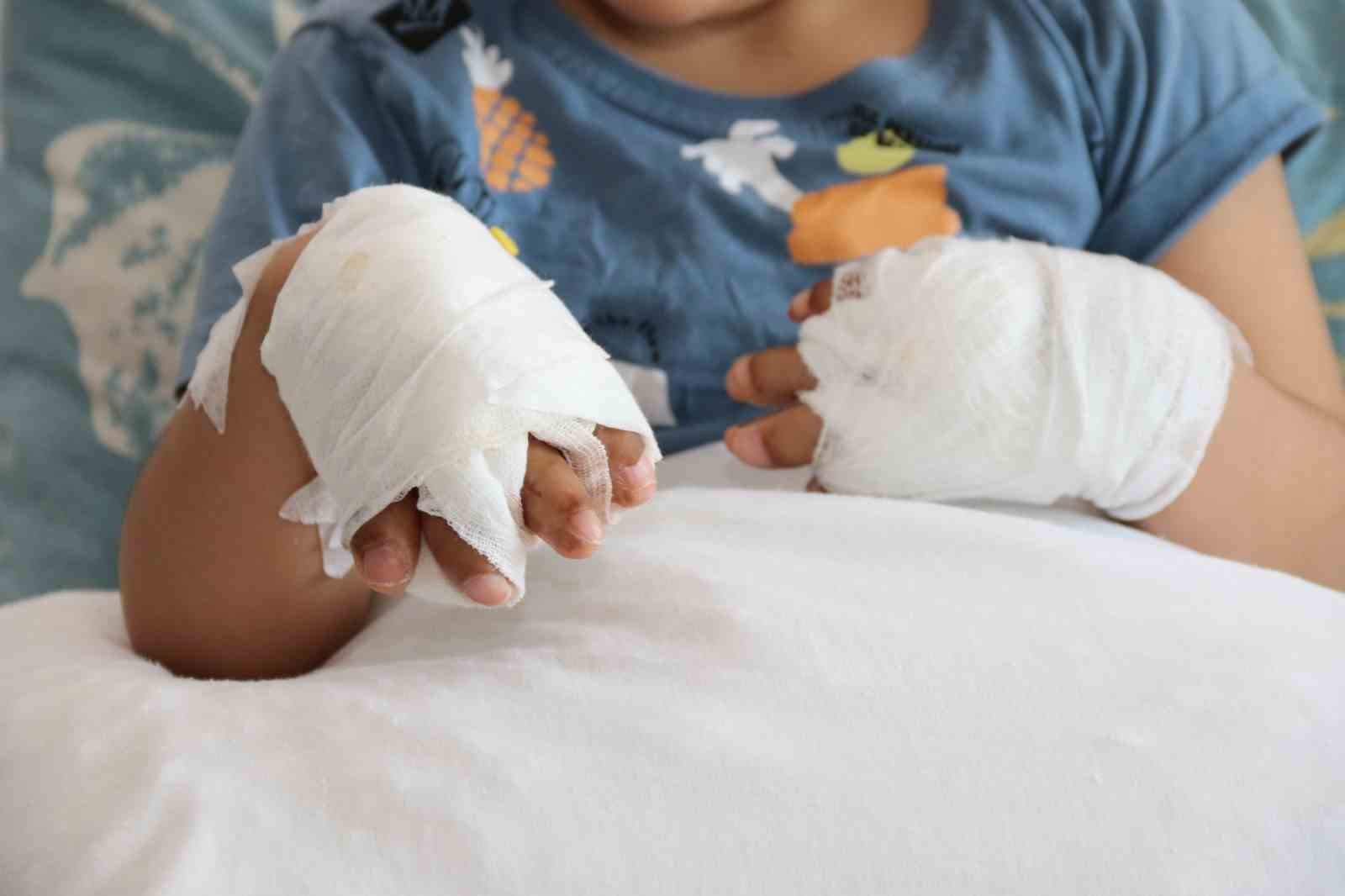 doktorlarin-ismini-yeni-duydugu-rahatsizlik-eskisehirde-tedavi-edildi-10-parmagi-acildi