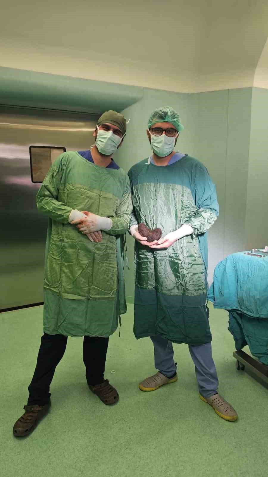 minik-kizin-midesinden-devasa-bir-sac-yumagi-cikti