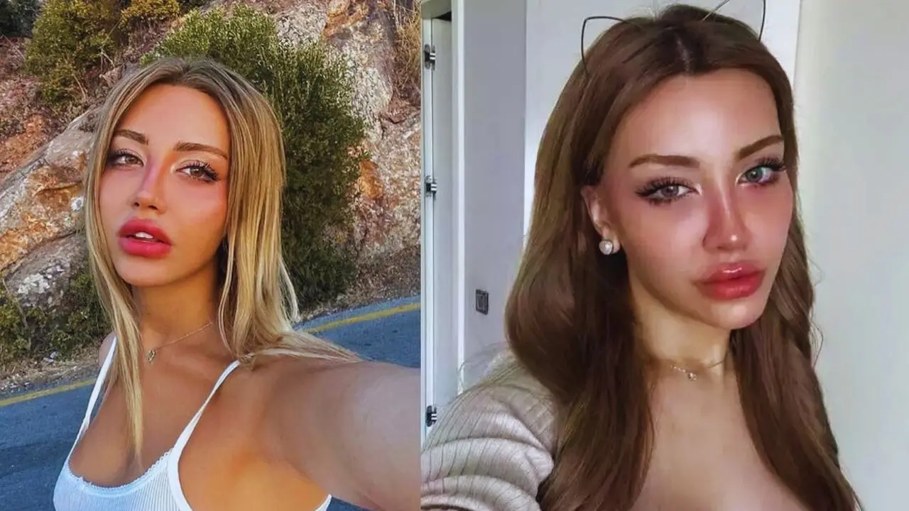 Şanlıurfalı Fenomen Mika Raun Kimdir?