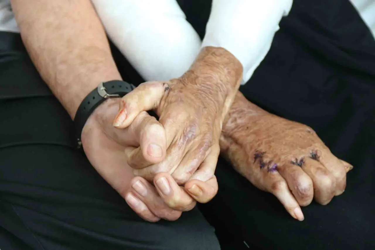 azerbaycanli-ciftin-dogal-gaz-patlamasinda-kapanan-elleri-3-yil-sonunda-eskisehirdeki-tedaviyle-kavustu