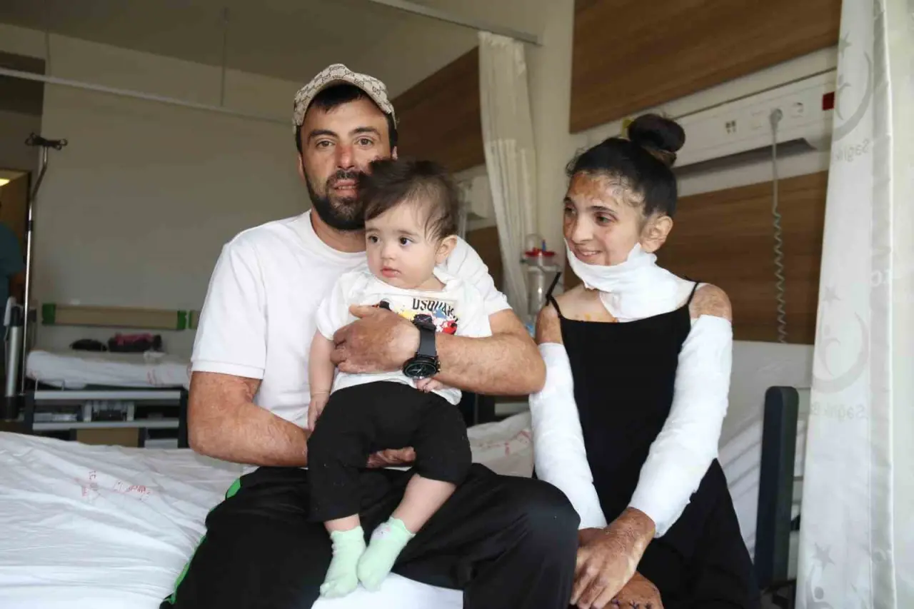 azerbaycanli-ciftin-dogal-gaz-patlamasinda-kapanan-elleri-3-yil-sonunda-eskisehirdeki-tedaviyle-kavustu