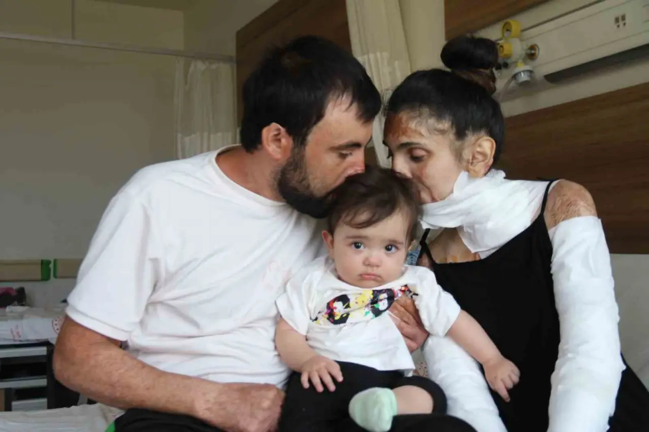 azerbaycanli-ciftin-dogal-gaz-patlamasinda-kapanan-elleri-3-yil-sonunda-eskisehirdeki-tedaviyle-kavustu